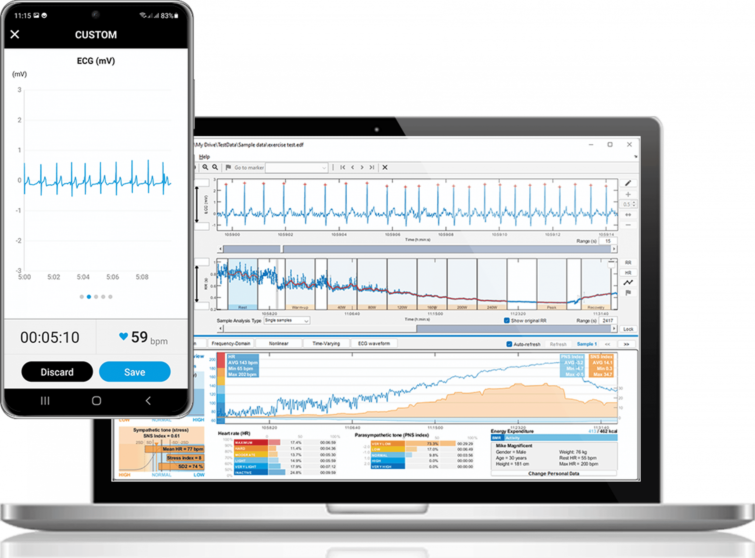 Kubios HRV Scientific software on smartphone and laptop showing ECG and HRV analysis screens