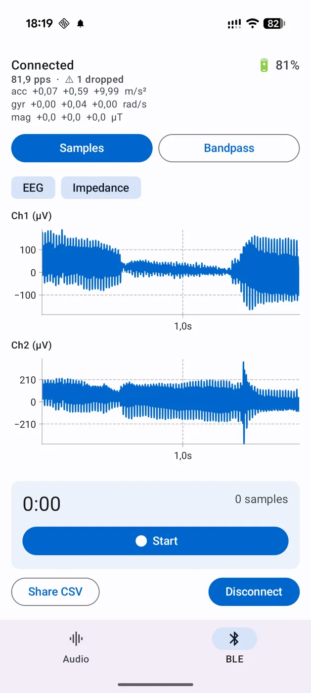 EEGenius (EEG, µV) live in der Android-BLE-Demo