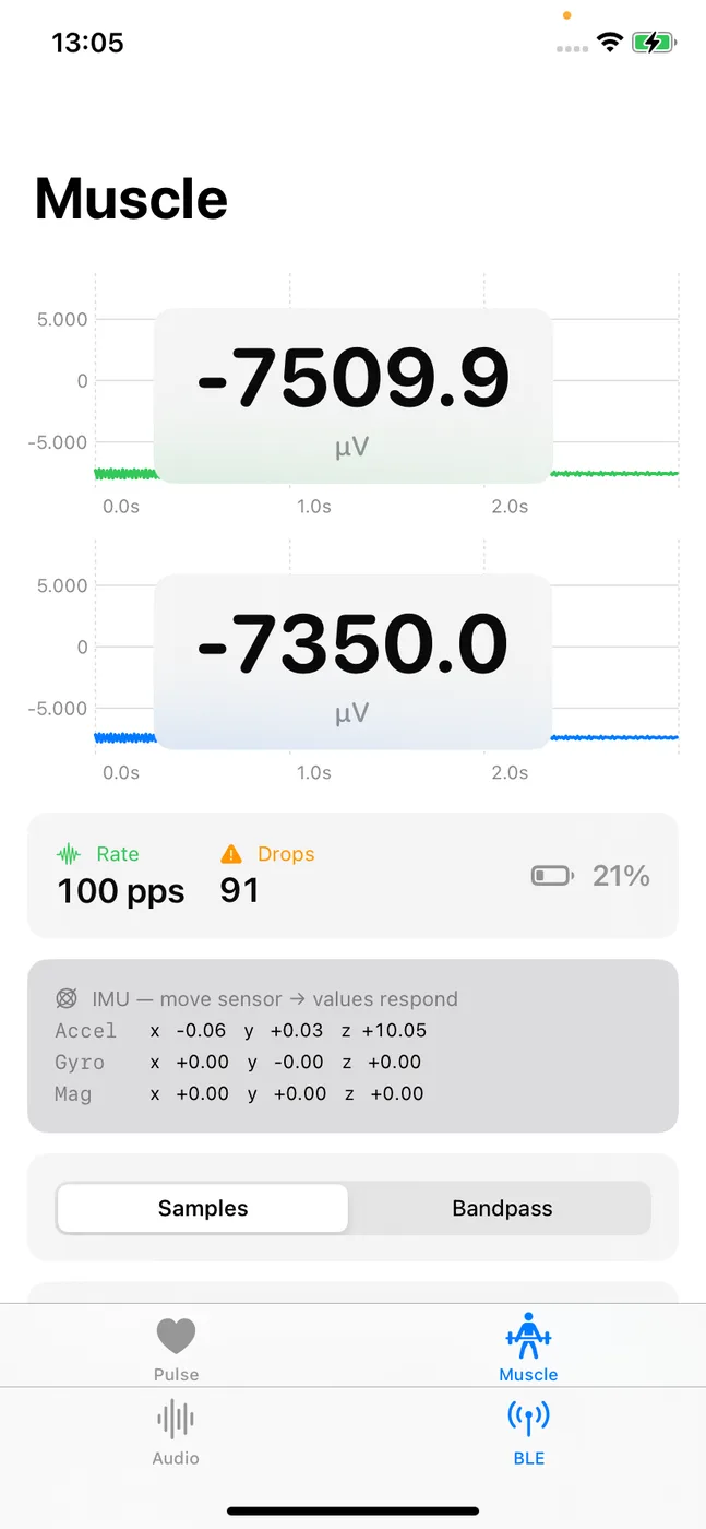 Muskulatur (EMG, 2 Kanäle, µV) live in der iOS-BLE-Demo