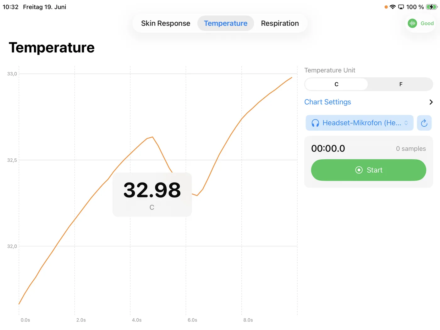 Hauttemperatur live in der iOS-Demo