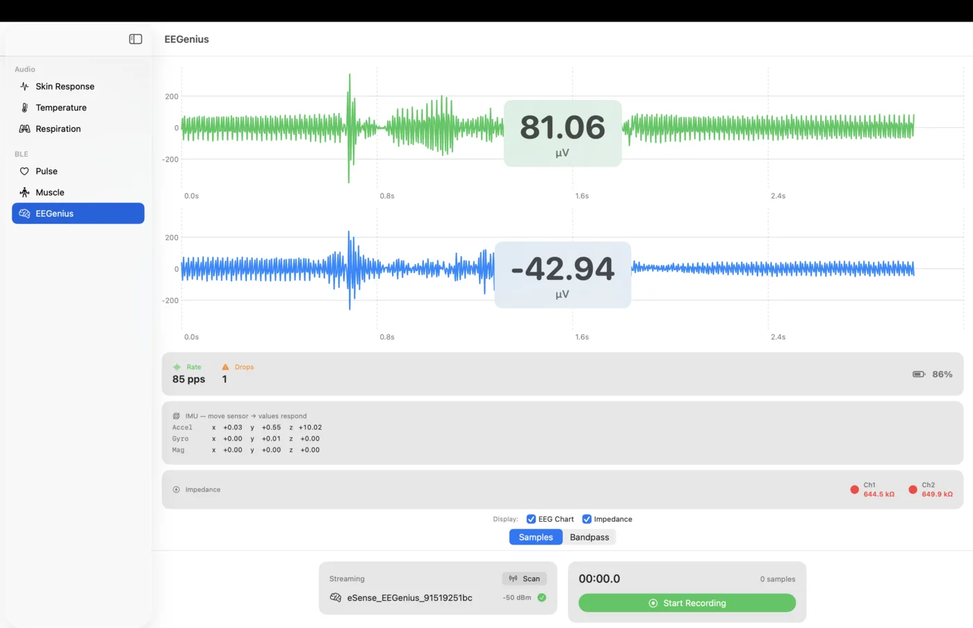 EEGenius (EEG, 2 Kanäle, µV) mit Impedanzanzeige live in der macOS-BLE-Demo