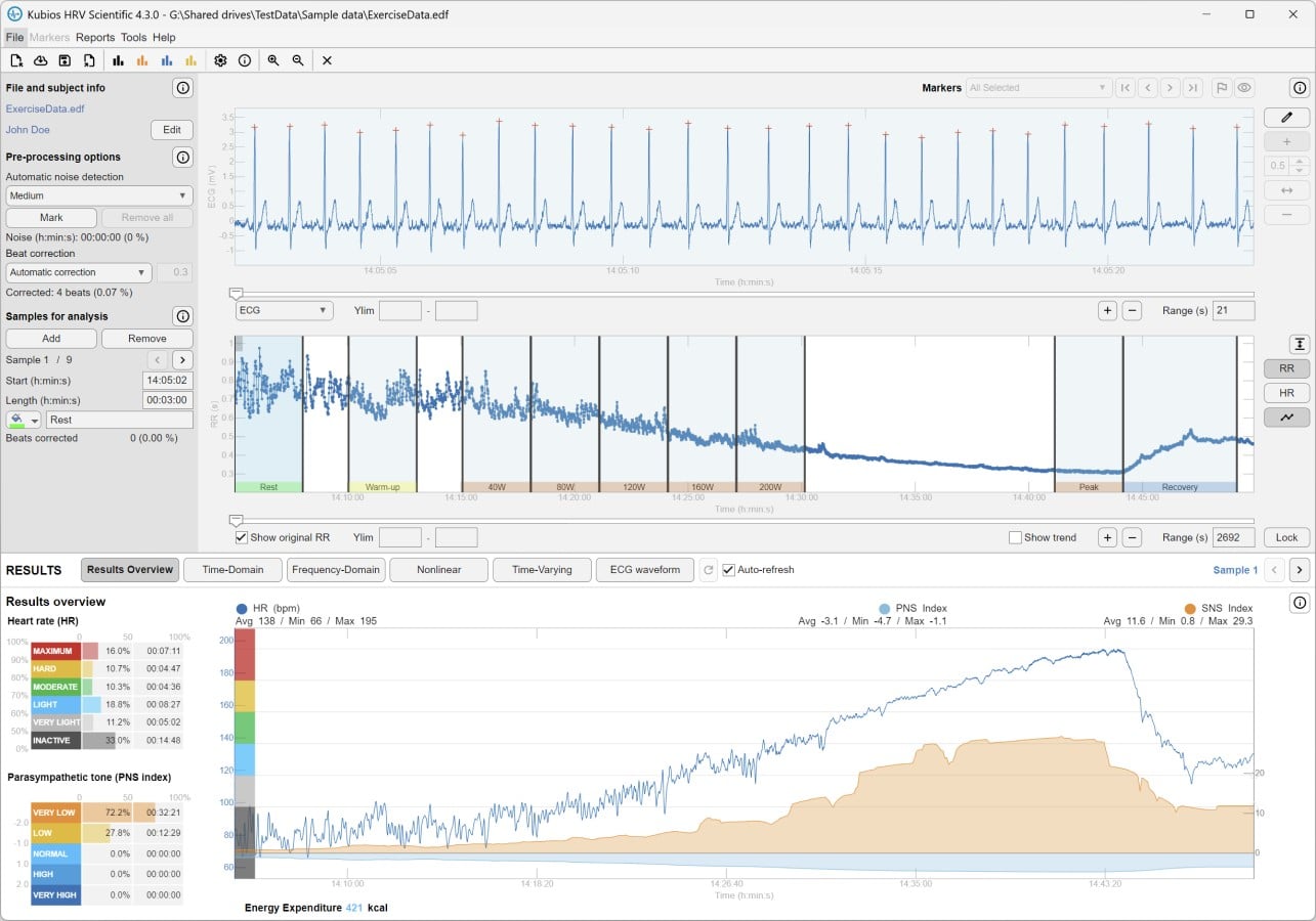 Screenshot der Kubios HRV Scientific 4.3 Software mit EKG-Kurve, RR-Trend und Ergebnisübersicht