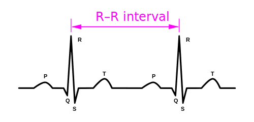 ECG diagram with P-QRS-T complex and the R-R interval marked between two R peaks