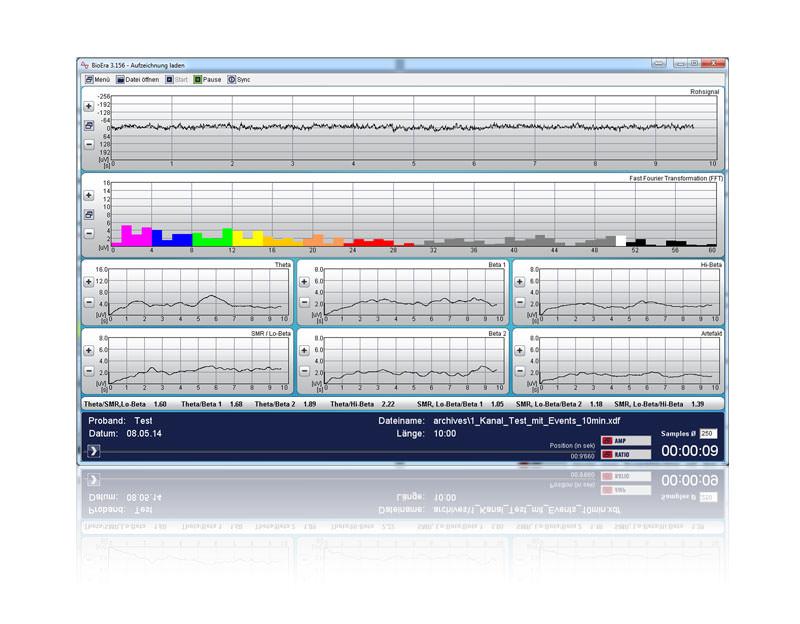 BioEra-Auswertungsbildschirm mit Rohsignal, FFT-Balken und Frequenzband-Kurven (Theta, Beta, SMR)