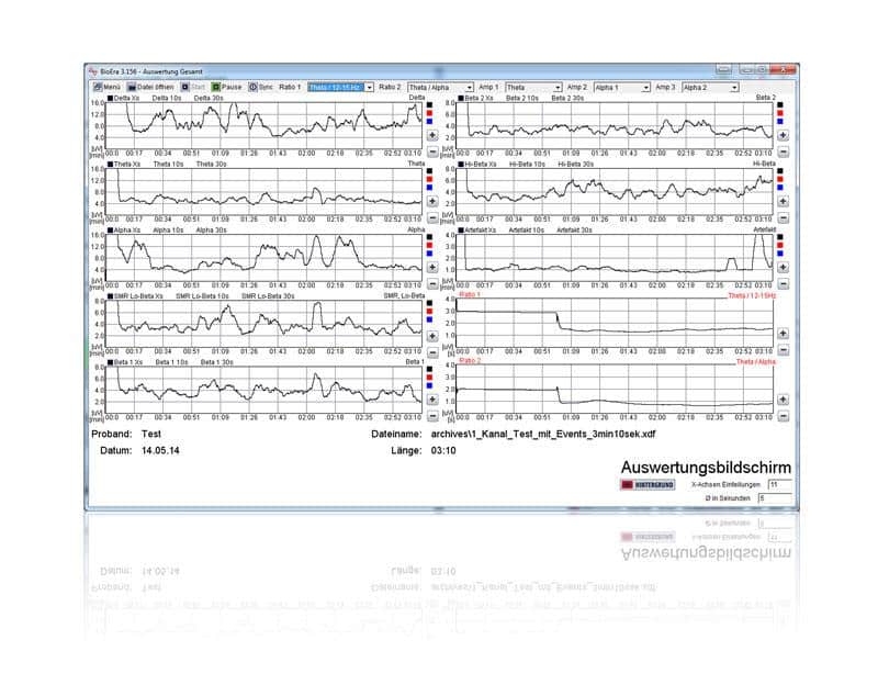 Neurofeedback-Software: Auswertungsbildschirm mit Trainingsverlaufs-Diagramm