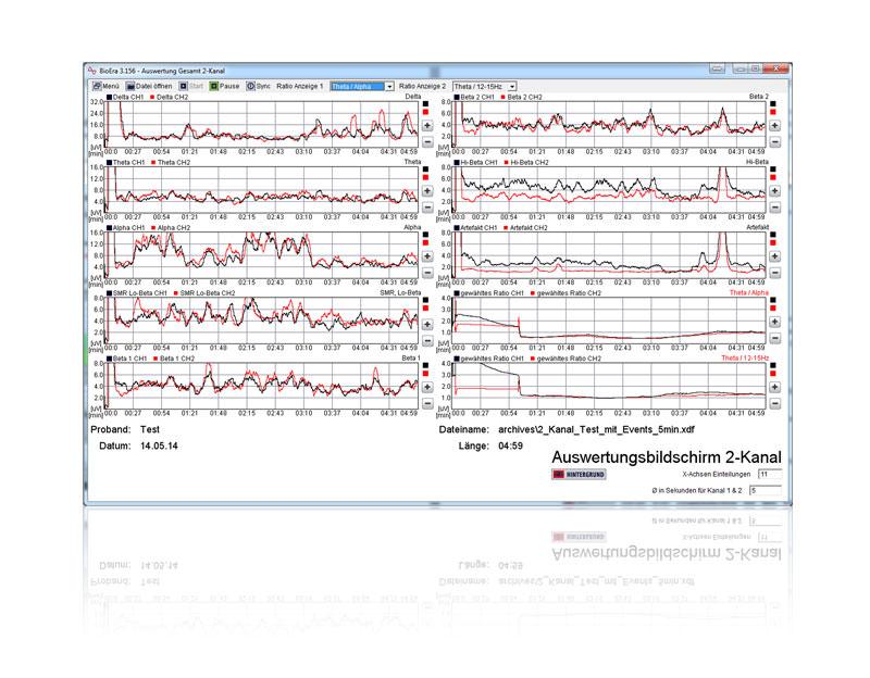 Bildschirmfoto der Neurofeedback-Auswertungssoftware mit zwei Kurvendiagrammen über die Zeit