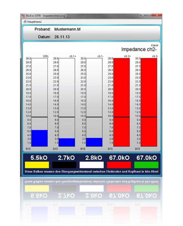 Screenshot of the impedance measurement screen with five colored bar charts showing electrode contact quality