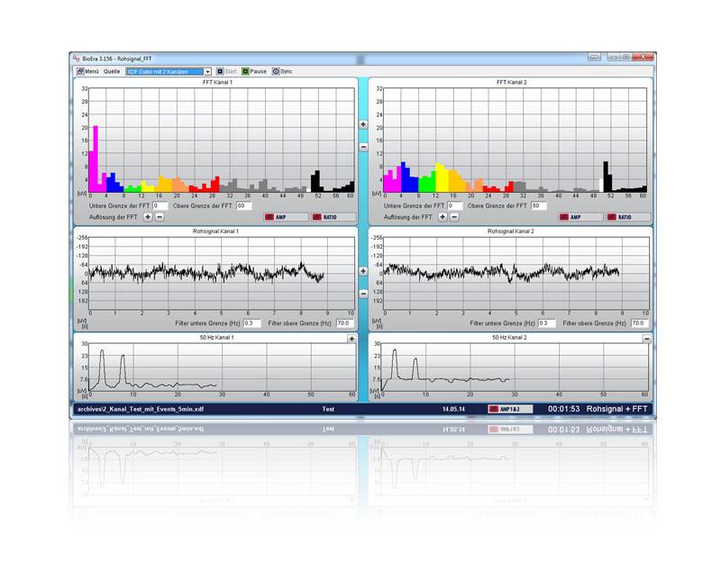 Software-Screenshot: Rohsignal- und FFT-Analyse für zwei EEG-Kanäle
