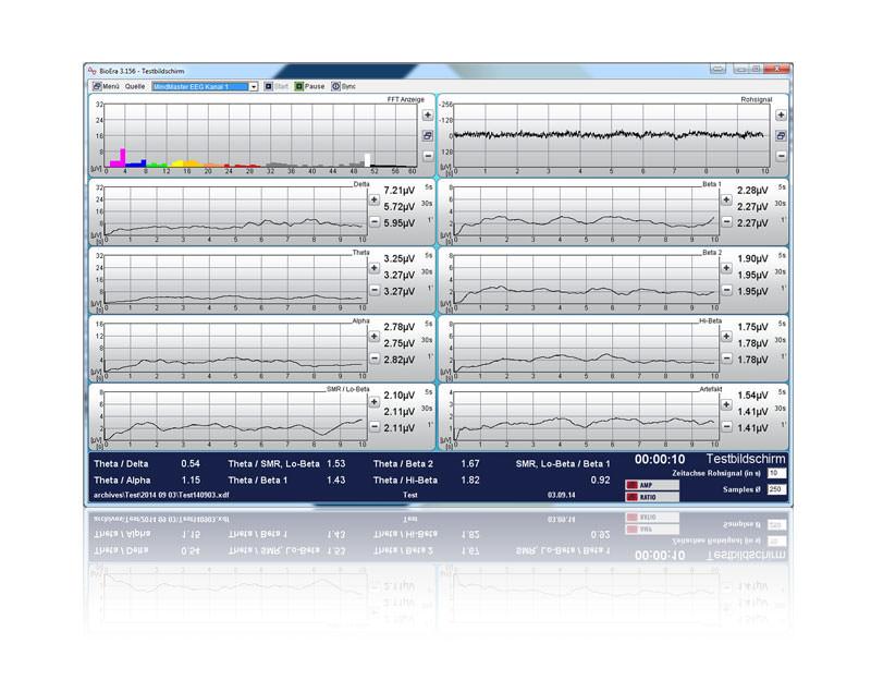 BioEra-Software: Testbildschirm mit Kanal-Frequenzbändern und Messwerttabelle