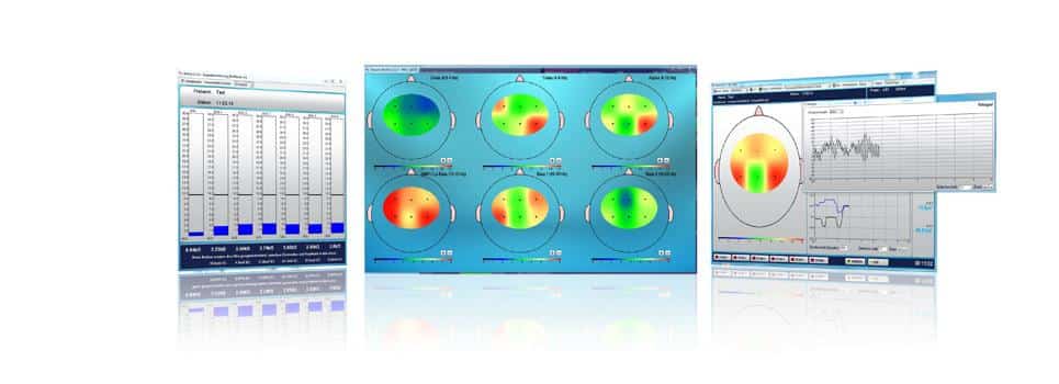 Collage des Mini-QEEG-Moduls: Datentabelle und farbige Hirnkarten der EEG-Frequenzbänder