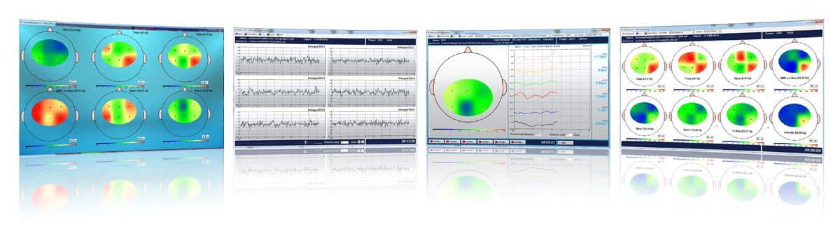 Collage der Neurofeedback-Module