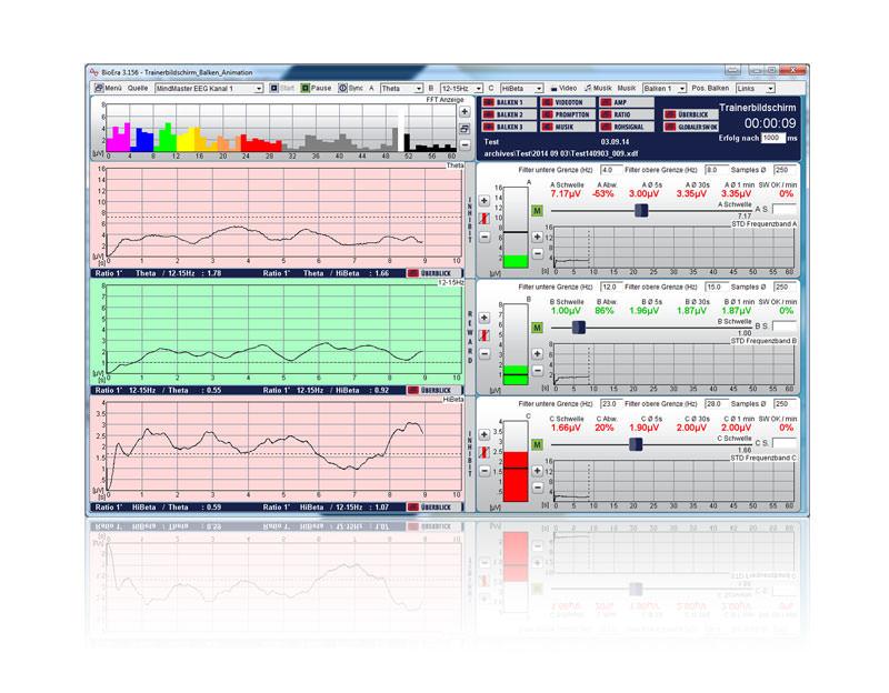 Software-Trainerbildschirm (1-Kanal) mit Frequenzbalken und drei EEG-Verlaufskurven