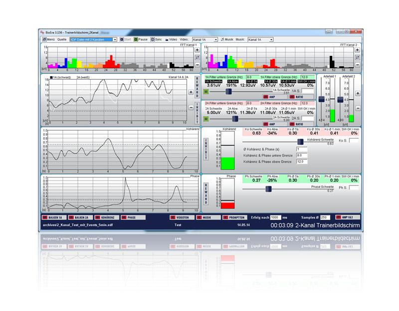 Neurofeedback-Software: 2-Kanal-Trainerbildschirm mit Balken und Kurven