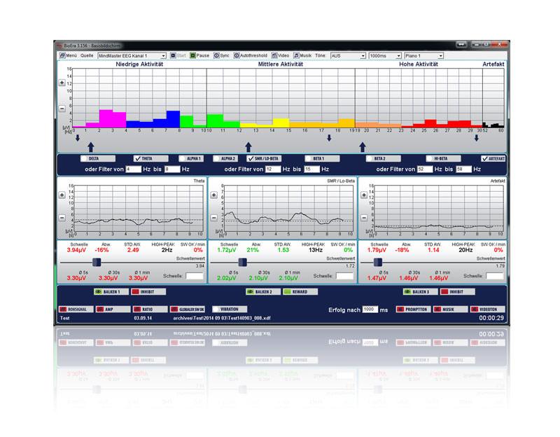 Software-Basisbildschirm: EEG-Frequenzbänder in niedrige, mittlere und hohe Aktivität unterteilt