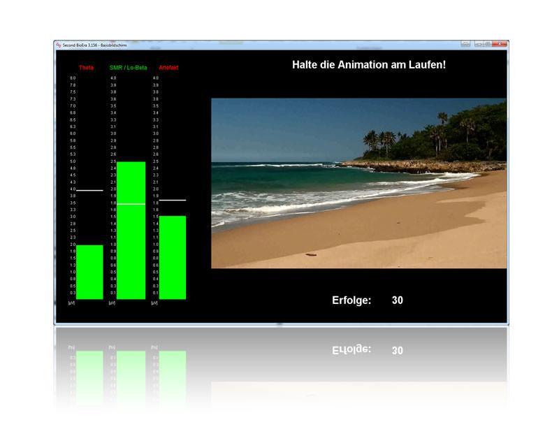 Neurofeedback-Software: Balkenanzeigen mit Strandvideo als Feedback-Animation