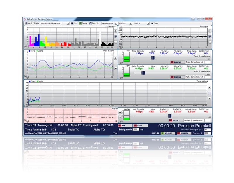 Neurofeedback-Software: Auswertung des Peniston-Protokolls